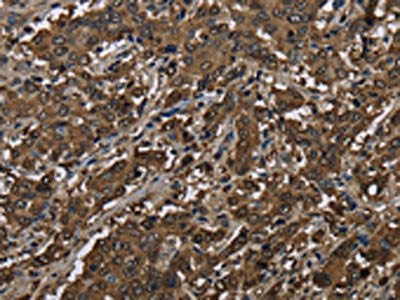 GSTP1 Antibody