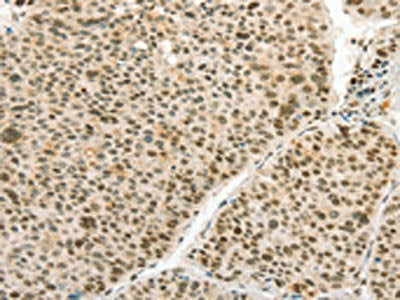ANGPT4 Antibody