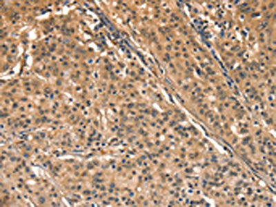AIMP1 Antibody
