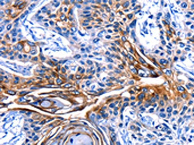 CLCA4 Antibody