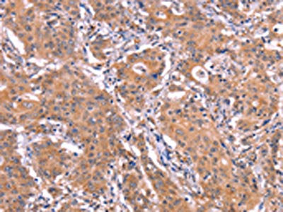 ETFB Antibody