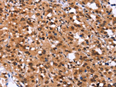 GPR124 Antibody