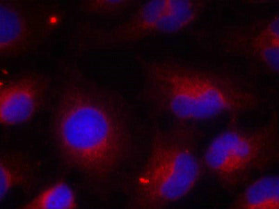 Phospho-PTEN (Ser380) Antibody