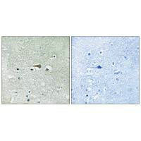 TTK (Ab-676) Antibody