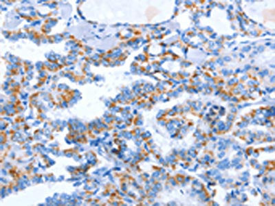 WNT1 Antibody