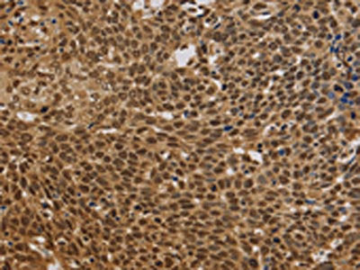 BRAF Antibody