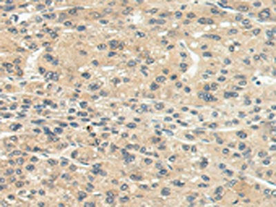CHRNA1 Antibody