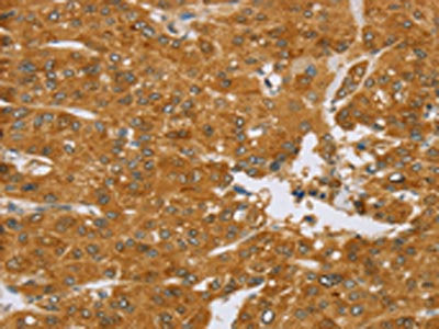 TNFSF13 Antibody