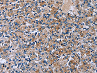 HSD3B2 Antibody