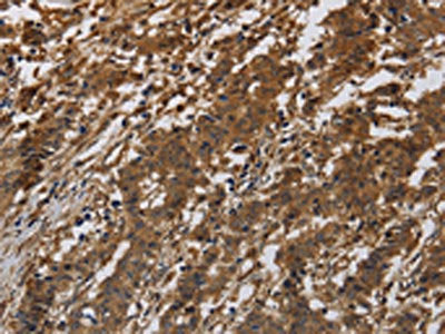 ITGB7 Antibody