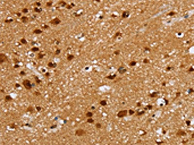 ZMAT3 Antibody