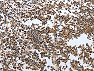 MSH6 Antibody