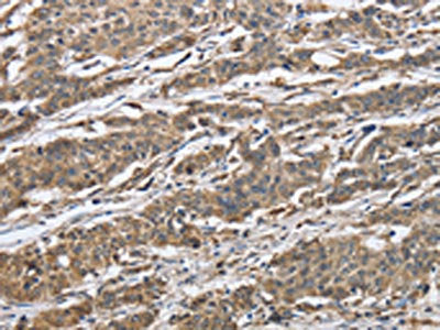 IPO7 Antibody