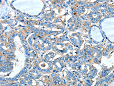 ADRA1A Antibody