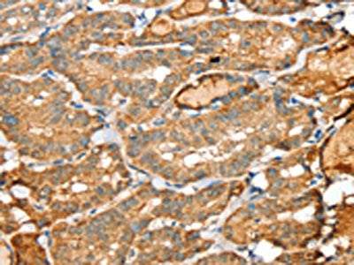 SIGLEC14 Antibody