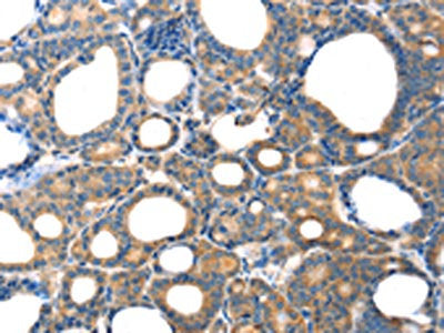TAC1 Antibody