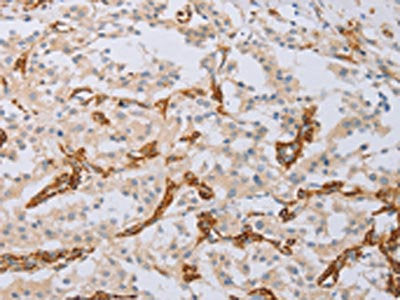 MYL6 Antibody