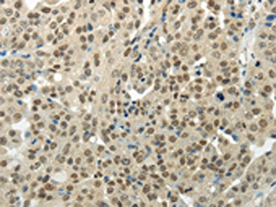 BAZ1B Antibody