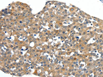 SCN11A Antibody