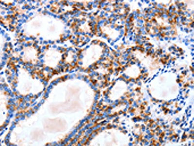IGSF6 Antibody