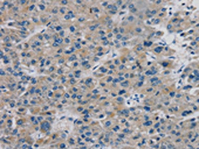 TBX18 Antibody
