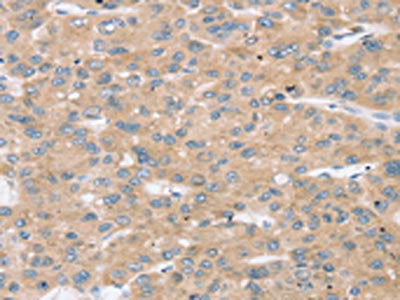 TBC1D4 Antibody