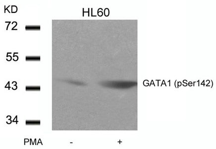 Phospho-GATA1 (Ser142) Antibody