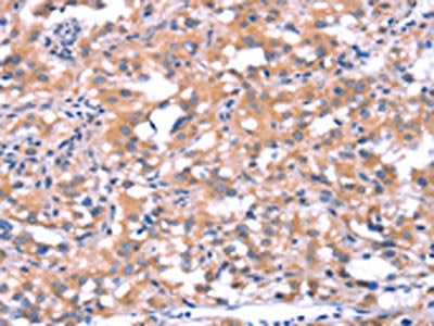 FAT1 Antibody