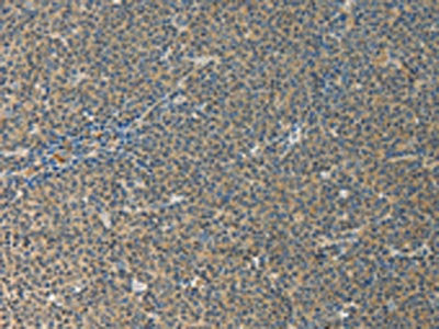 IL27 Antibody