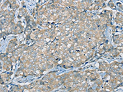 SERPINA11 Antibody