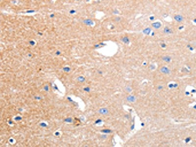 KCNH3 Antibody