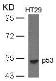 TP53 (Ab-33) Antibody