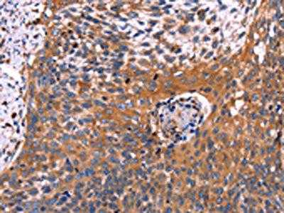 RDX Antibody