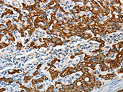 KRT18 Antibody