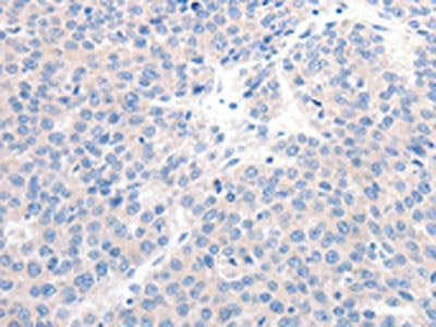 GCK Antibody