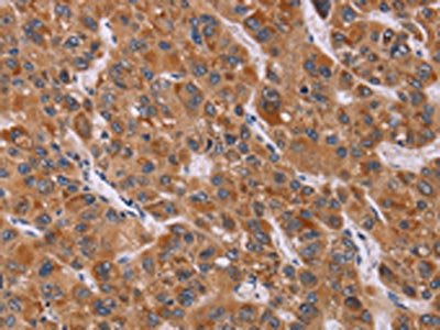 CALCA Antibody