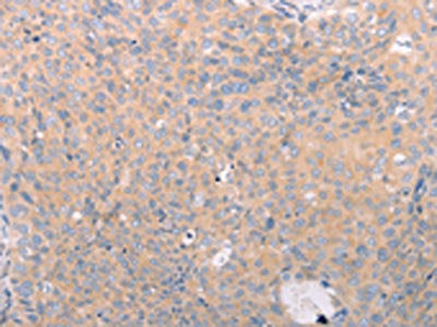 ABCF3 Antibody