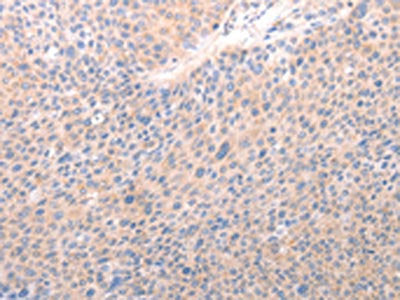 ACO1 Antibody