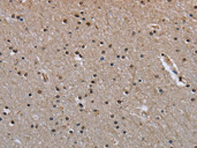 MVD Antibody