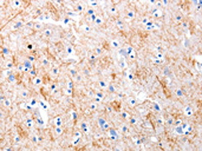 KISS1 Antibody