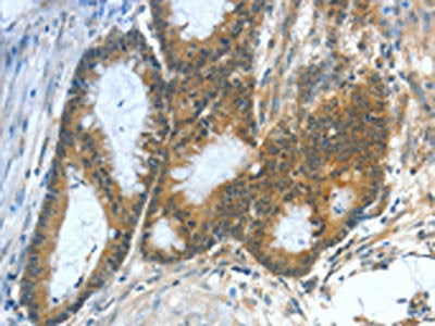 ASNS Antibody