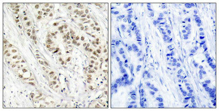 Phospho-BRCA1 (Ser1524) Antibody