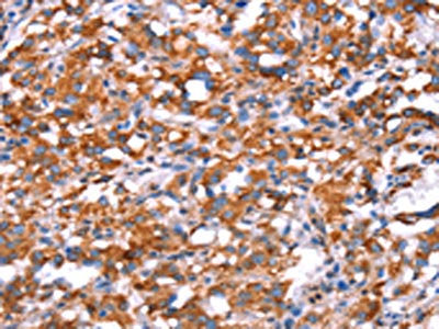 GH1 Antibody