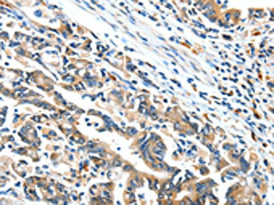 BCL2L2 Antibody