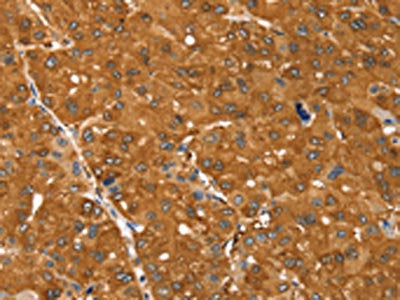 SSTR3 Antibody