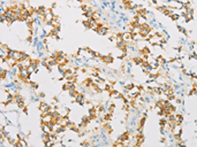 IDH3B Antibody
