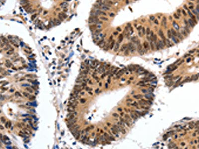 CMTM3 Antibody
