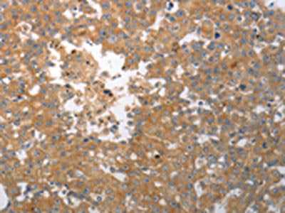 SHH Antibody