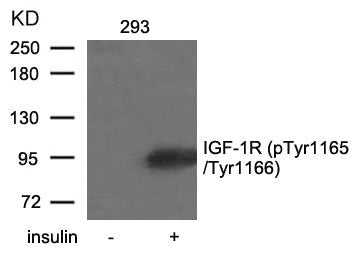 Phospho-IGF1R (Tyr1165/Tyr1166) Antibody