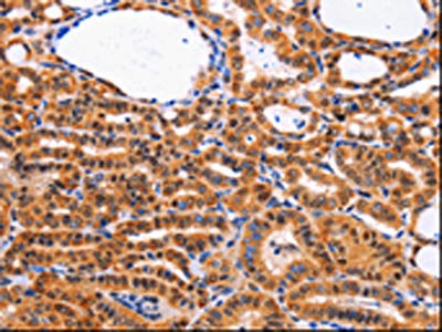 CDK4 Antibody